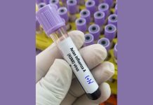 Influenza aviaria, primo caso umano in Europa: paziente ricoverato in Lombardia