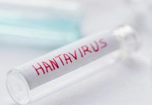 Hantavirus sulla Hondius, muore un agente a Tenerife